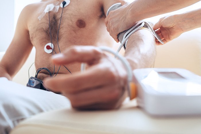 Holter ECG